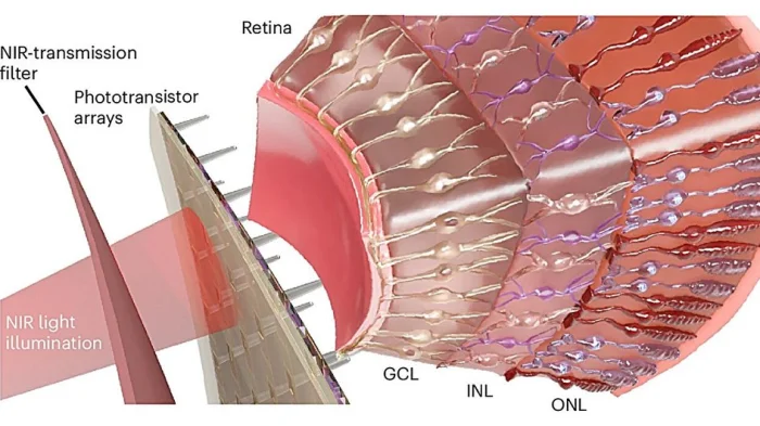 Схема искусственной сетчатки, воспринимающей ближний инфракрасный свет, с ИК-фильтром пропускания и массивом фототранзисторов.