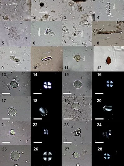 Примеры микроостатков, обнаруженных в зубном камне